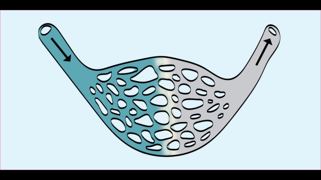 292. Acute Limb Ischemia