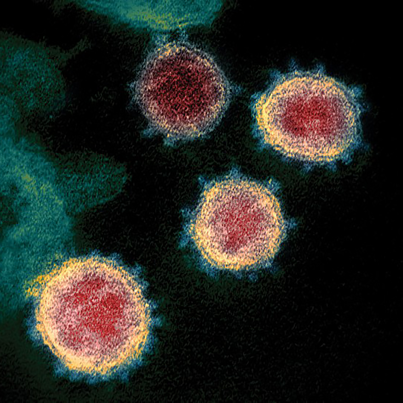 Ep. 29: This virus is here now, it's going to stay with us