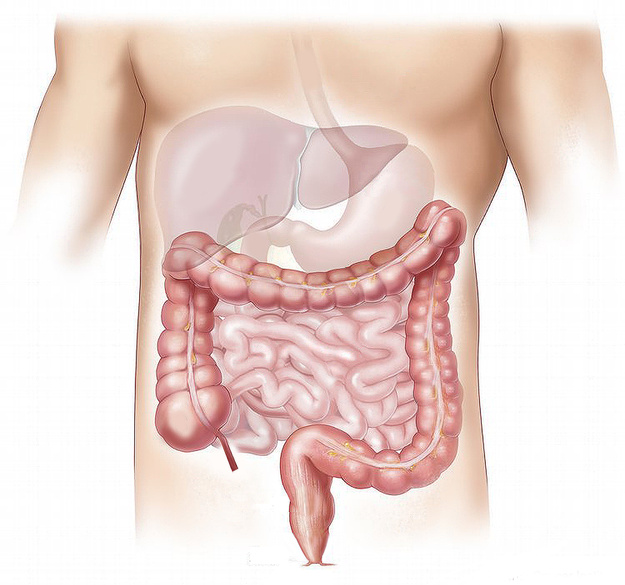 289. Acute Abdomen