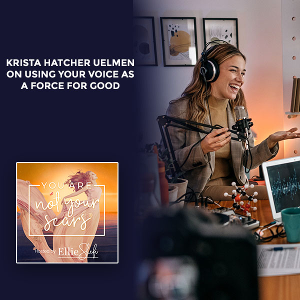 You Are Not Your Scars